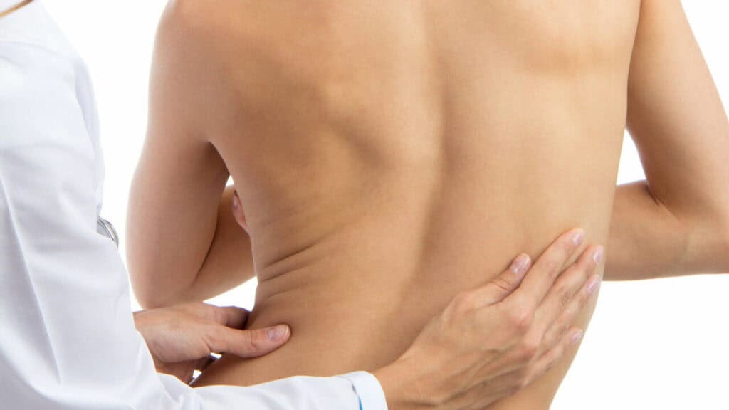 physiotherapy for scoliosis cambridge