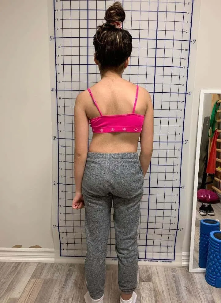 physiotherapy for scoliosis