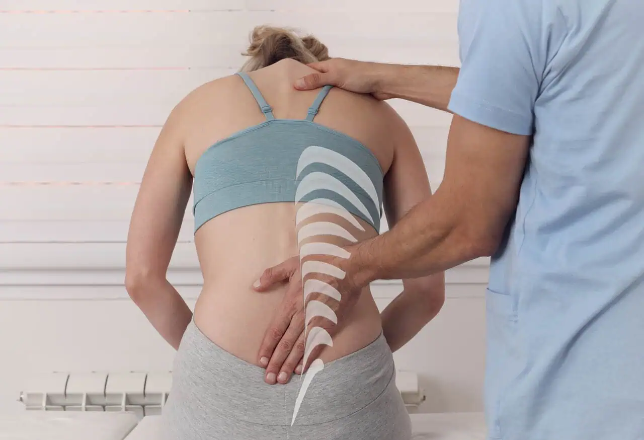 scoliosis physical therapy cambridge