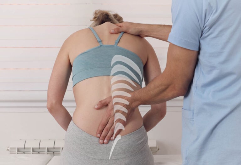 scoliosis management cambridge