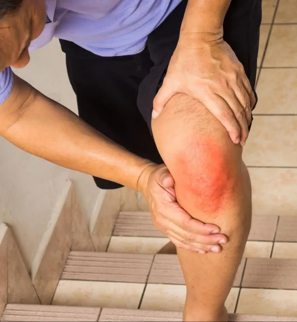 Best Hip and Knee Osteoarthritis Treatment Cambridge